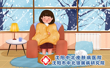 天气凉会导致手背牛皮癣吗?