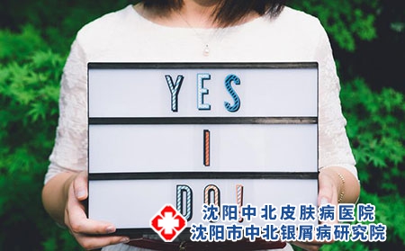 牛皮癣的临床分型有哪几种？