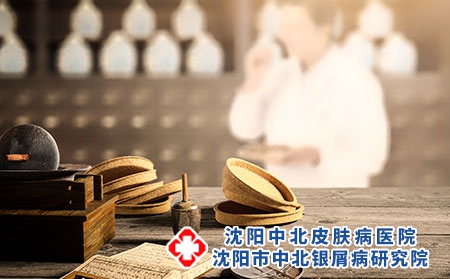 中药治疗牛皮癣 6个中医方法介绍