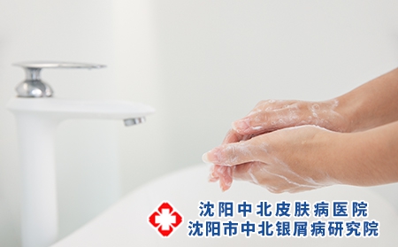 外洗治疗牛皮癣的方法？