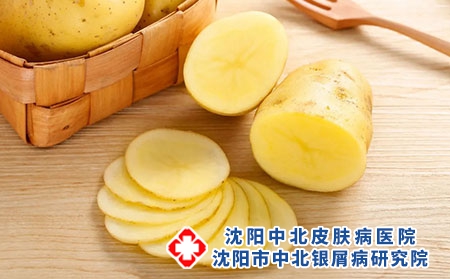 吃什么菜治疗牛皮癣？