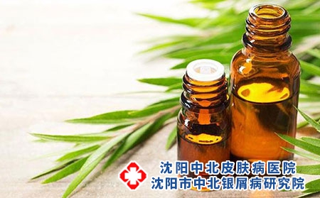 治牛皮癣最好的偏方？