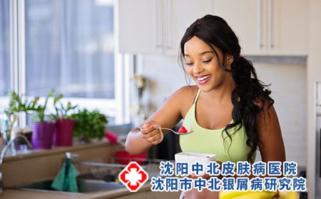 怎么治疗牛皮癣才能不反复？