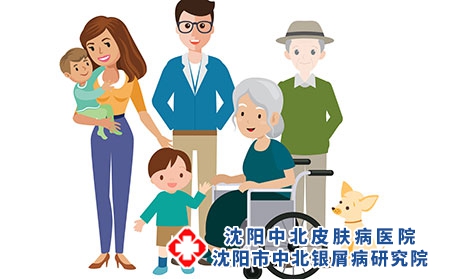 冬季哪几类人容易患上牛皮癣？