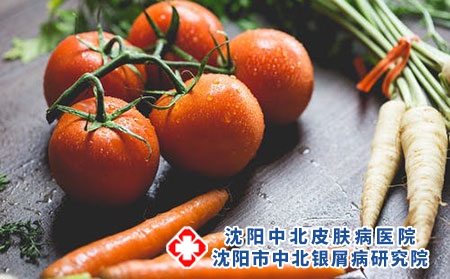 有利于牛皮癣排毒的水果有哪些？