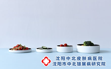 牛皮癣的护理要点 牛皮癣的饮食调理