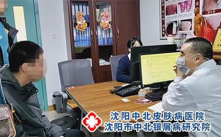 沈阳哪看银屑病好-沈阳市中北银屑病研究院-沈阳哪里能治银屑病