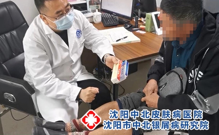 沈阳哪有治银屑病-沈阳中北银屑病研究院-沈阳银屑病哪治最好