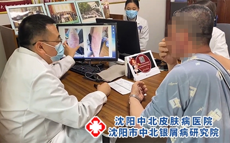沈阳哪治银屑病好-沈阳中北银屑病研究院-沈阳治疗银屑病去哪
