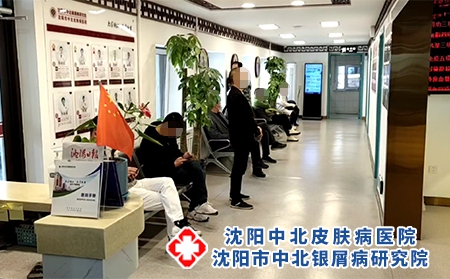 沈阳银屑病哪里治-沈阳中北银屑病医院-沈阳治牛皮癣哪儿好