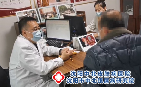 沈阳哪治牛皮癣好-沈阳中北银屑病研究院-沈阳银屑病哪治的好