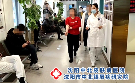 沈阳牛皮癣咋治疗-沈阳中北银屑病研究院-沈阳哪能治好银屑病