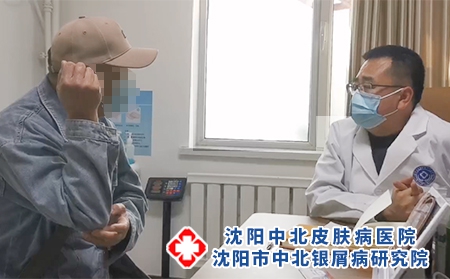 中北医院牛皮癣坐诊专家 - 沈阳中北医院