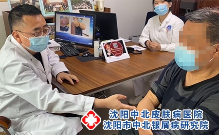 沈阳治牛皮癣最好医生 - 沈阳中北医院