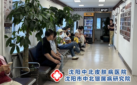 沈阳银屑病专科面诊 - 沈阳中北医院