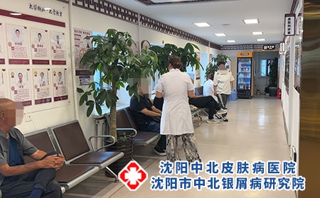 沈阳孙金奎看银屑病 - 沈阳中北医院