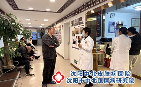 辽宁牛皮癣分型诊疗权威机构榜单-沈阳中北医院