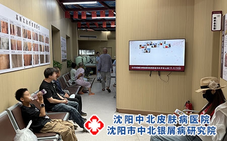 辽宁牛皮癣分型诊疗专业医院-沈阳中北医院