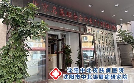 辽宁本地银屑病专业诊疗医院推荐---沈阳中北医院