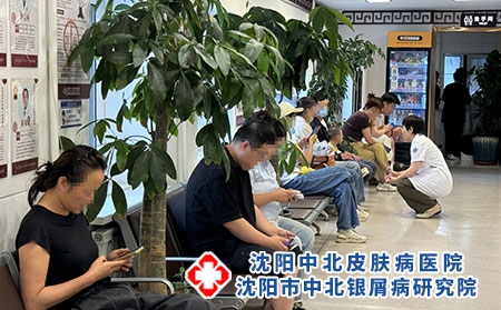 辽宁牛皮癣专科口碑诊疗机构-沈阳中北医院
