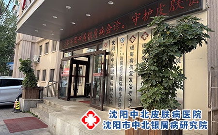 辽宁牛皮癣诊疗靠谱医院排名---沈阳中北医院