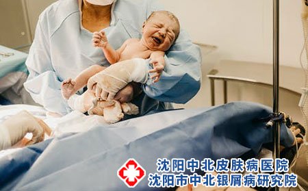 银屑病医院科普患者朋友冬季如何护理