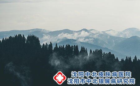 沈阳中北银屑病医院：银屑病真的很难治疗吗