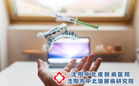 银屑病应该怎么治疗才能好的快