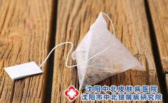 沈阳中北银屑病医院讲得了银屑病有哪些危害